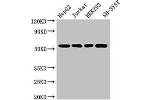 Western Blot Positive WB detected in: HepG2 whole cell lysate, Jurkat whole cell lysate, HEK293 whole cell lysate, SH-SY5Y whole cell lysate All lanes: DCTN4 antibody at 3.