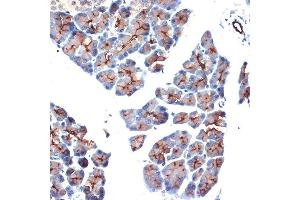 Immunohistochemistry (IHC) image for anti-Mucin 1 (MUC1) (AA 1182-1255) antibody (ABIN6144194)