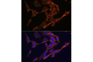 Immunofluorescence analysis of C6 cells using  Rabbit mAb (ABIN6134271, ABIN6138179, ABIN6138182 and ABIN7101399) at dilution of 1:100 (40x lens). (AGR2 antibody)