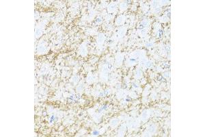 Immunohistochemistry of paraffin-embedded rat brain using CNP antibody. (Cnpase antibody  (AA 152-421))