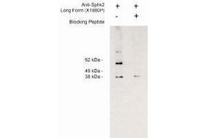 Image no. 1 for anti-Sphingosine Kinase 2 (SPHK2) (Long Isoform), (N-Term) antibody (ABIN4620350) (SPHK2 antibody  (Long Isoform, N-Term))
