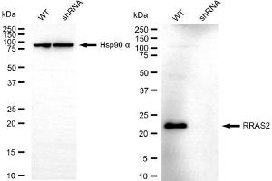 Western blotting analysis using RRAS2 antibody (ABIN7800167).