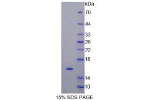SDS-PAGE analysis of Human ELOC Protein.