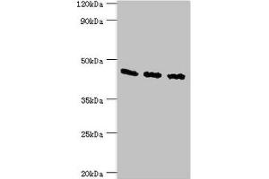 Western blot All lanes: Flotillin-2 antibody at 4 μg/mL Lane 1: A549 whole cell lysate Lane 2: Hela whole cell lysate Lane 3: Rat brain tissue Secondary Goat polyclonal to rabbit IgG at 1/10000 dilution Predicted band size: 47 kDa Observed band size: 47 kDa (Flotillin 2 antibody  (AA 239-428))