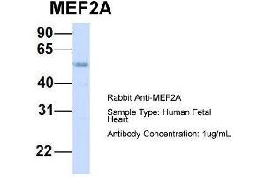 Host:  Rabbit  Target Name:  MEF2A  Sample Type:  Human Fetal Heart  Antibody Dilution:  1. (MEF2A antibody  (Middle Region))