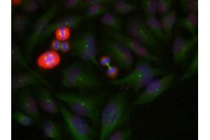 Immunofluorescence staining of methanol-fixed Hela cells using c-Jun(Phospho-Thr239) Antibody. (C-JUN antibody  (pThr239))