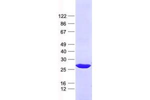 Chromosome 13 Open Reading Frame 27 (C13orf27) protein (His tag)