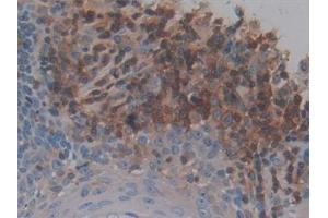 Immunohistochemistry (IHC) image for anti-Neuropeptide Y (NPY) (AA 30-97) antibody (ABIN7432820)
