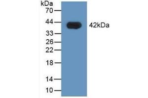 Detection of Recombinant HNRPA1, Human using Polyclonal Antibody to Heterogeneous Nuclear Ribonucleoprotein A1 (HNRNPA1) (HNRNPA1 antibody  (AA 2-372))