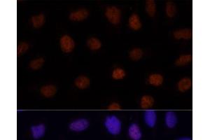 Immunofluorescence analysis of U-2 OS cells using GLI2 Polyclonal Antibody at dilution of 1:100. (GLI2 antibody)