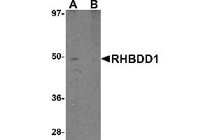 Western blot analysis of RHBDD1 in K562 cell lysate with RHBDD1 antibody at 1 µg/mL in (A) the absence and (B) the presence of blocking peptide. (RHBDD1 antibody  (C-Term))