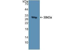 Detection of Recombinant ADCY3, Human using Polyclonal Antibody to Adenylate Cyclase 3 (ADCY3) (ADCY3 antibody  (AA 501-736))