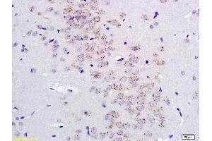 Formalin-fixed and paraffin embedded rat brain labeled with Anti GABRA2/GABA A Receptor alpha 2 Polyclonal Antibody, Unconjugated (ABIN1387528) at 1:200 followed by conjugation to the secondary antibody and DAB staining