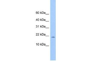 WB Suggested Anti-C10orf83 Antibody Titration: 0. (MORN4 antibody  (Middle Region))