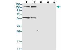 Western blot analysis of Lane 1: RT-4, Lane 2: U-251 MG, Lane 3: Human Plasma, Lane 4: Liver, Lane 5: Tonsil with KIF4A polyclonal antibody  at 1:250-1:500 dilution. (KIF4A antibody)