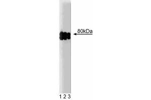 Western blot analysis of CLA-1 on a HeLa cell lysate (Human cervical epitheloid carcinoma, ATCC CCL-2. (SCARB1 antibody  (AA 104-294))
