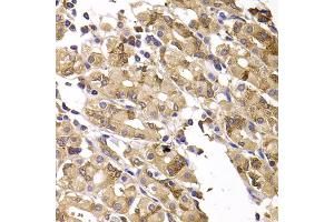 Immunohistochemistry of paraffin-embedded human gastric injury using ASMTL antibody (ABIN5975463) at dilution of 1/100 (40x lens). (ASMTL antibody)