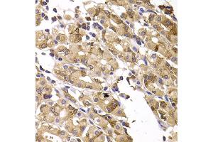 Immunohistochemistry of paraffin-embedded human gastric injury using ASMTL antibody (ABIN5975463) at dilution of 1/100 (40x lens).