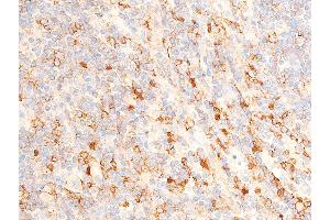 ABIN6267224 at 1/100 staining human appendiceal tissue sections by IHC-P. (CHEK1 antibody  (pSer317))