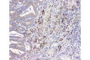 IHC analysis of RRBP1 using anti-RRBP1 antibody (ABIN6719628). (RRBP1 antibody)