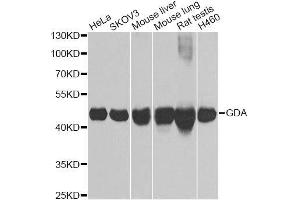 Western blot analysis of extracts of various cell lines, using GDA Antibody. (GDA antibody  (AA 165-454))
