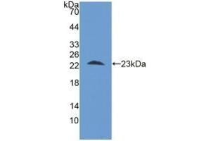 Detection of Recombinant STIP1, Human using Polyclonal Antibody to Stress Induced Phosphoprotein 1 (STIP1) (STIP1 antibody  (AA 1-169))