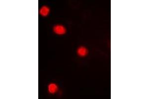 Immunofluorescent analysis of MAPKAPK3 staining in Hela cells. (MAPKAP Kinase 3 antibody  (C-Term))