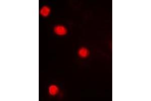 Immunofluorescent analysis of MAPKAPK3 staining in Hela cells.