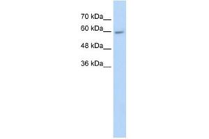 CYP4F11 antibody used at 5 ug/ml to detect target protein. (CYP4F11 antibody  (N-Term))