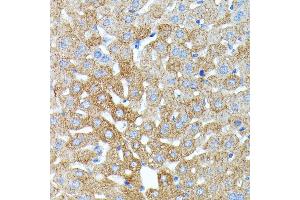 Immunohistochemistry of paraffin-embedded mouse liver using Haptoglobin (Haptoglobin (HP)) antibody (ABIN3022157, ABIN3022158, ABIN1513029, ABIN1514188 and ABIN6218636) at dilution of 1:100 (40x lens). (Haptoglobin antibody)