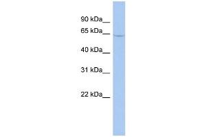 WB Suggested Anti-MAOA Antibody Titration: 0. (Monoamine Oxidase A antibody  (N-Term))