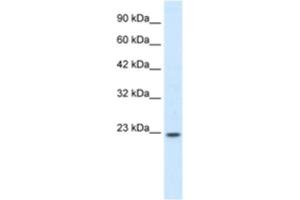 Western Blotting (WB) image for anti-Homeobox B6 (HOXB6) antibody (ABIN2460208)