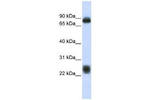 Tetraspanin 8 antibody used at 1 ug/ml to detect target protein.