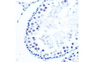 anti-Polymerase (DNA Directed), beta (POLB) antibody