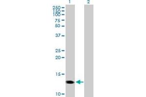 Western Blot analysis of CMTM1 expression in transfected 293T cell line by CMTM1 MaxPab polyclonal antibody. (CMTM1 antibody  (AA 1-114))