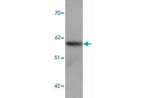 Western blot analysis of SLC39A5 in human spleen tissue lysate with SLC39A5 polyclonal antibody  at 1 ug/mL.