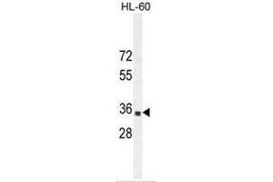 B3GNT4 Antaibody (Center) western blot analysis in HL-60 cell line lysates (35µg/lane). (B3GNT4 antibody  (Middle Region))