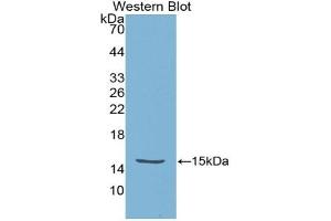 Detection of Recombinant HTRA1, Escherichia coli using Polyclonal Antibody to High Temperature Requirement Factor A1 (HTRA1) (HTRA1 antibody  (AA 304-442))