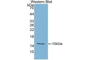 Detection of Recombinant HTRA1, Escherichia coli using Polyclonal Antibody to High Temperature Requirement Factor A1 (HTRA1) (High Temperature Requirement Factor A1 (AA 304-442) antibody)