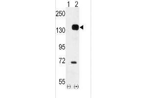 Western blot analysis of TEK (arrow) using rabbit polyclonal TEK Antibody (C-term) (ABIN392059 and ABIN2841824). (TEK antibody  (C-Term))