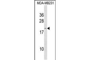 Western blot analysis in MDA-MB231 cell line lysates (35ug/lane). (IFNA6 antibody  (C-Term))
