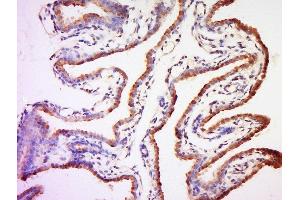Formalin-fixed and paraffin embedded mouse placenta labeled with Anti-MC4 Receptor Polyclonal Antibody, Unconjugated  at 1:200 followed by conjugation to the secondary antibody and DAB staining. (MC4R antibody  (AA 1-50))