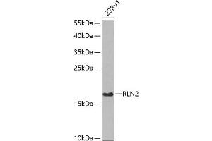 Western blot analysis of extracts of 22Rv1 cells, using RLN2 antibody (ABIN6129627, ABIN6146976, ABIN6146977 and ABIN6222724) at 1:1000 dilution. (Relaxin 2 antibody  (AA 25-185))