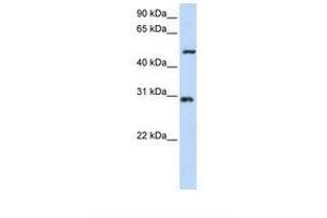 Image no. 1 for anti-Zinc Finger Protein 138 (ZNF138) (N-Term) antibody (ABIN6738383) (ZNF138 antibody  (N-Term))