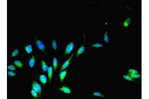 Immunofluorescent analysis of Hela cells using ABIN7148498 at dilution of 1:100 and Alexa Fluor 488-congugated AffiniPure Goat Anti-Rabbit IgG(H+L) (COPS7A antibody  (AA 1-275))