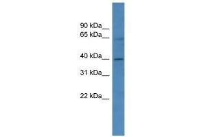 WB Suggested Anti-ZNF579 Antibody Titration:  0.