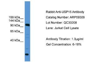 WB Suggested Anti-USP15  Antibody Titration: 0.