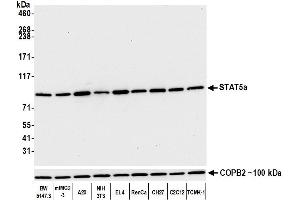 Western Blotting (WB) image for anti-Signal Transducer and Activator of Transcription 5A (STAT5A) (AA 744-794) antibody (ABIN7454017) (Recombinant STAT5A antibody  (AA 744-794))