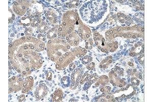 Immunohistochemistry (IHC) image for anti-Signal Sequence Receptor, alpha (SSR1) (N-Term) antibody (ABIN2782211) (SSR1 antibody  (N-Term))