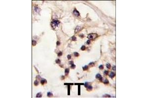 Formalin-fixed and paraffin-embedded human testis tissue reacted with TESK2 antibody (Center) f , which was peroxidase-conjugated to the secondary antibody, followed by DAB staining. (TESK2 antibody  (AA 210-240))